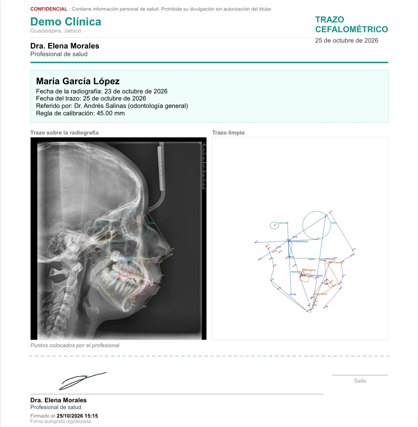 Primera hoja del PDF de un trazo aprobado: encabezado de la clínica, datos del paciente y del trazo, la radiografía con el trazo, el trazo limpio y la firma de la profesional