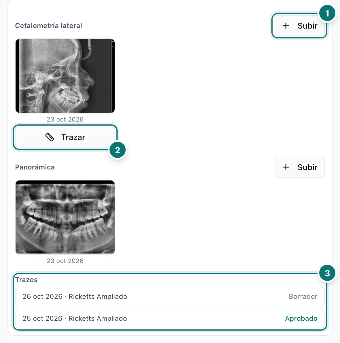 Tarjeta Radiografías con el botón Subir de la cefalometría lateral, el botón Trazar debajo de la radiografía y la lista de trazos con uno en borrador y otro aprobado, numerados del 1 al 3
