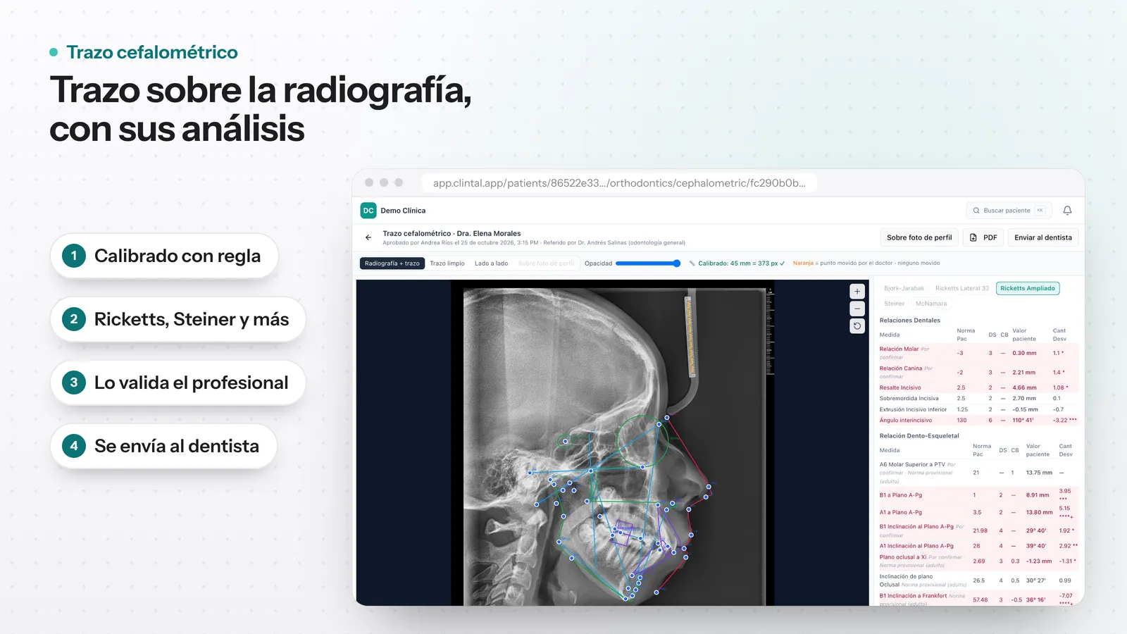 Editor de trazo cefalométrico sobre la radiografía lateral, con los puntos colocados y la tabla de medidas del análisis a la derecha